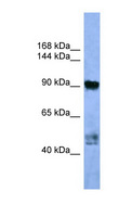 AP2A2 Antibody - AP2A2 antibody Western blot of Fetal Lung lysate.  This image was taken for the unconjugated form of this product. Other forms have not been tested.