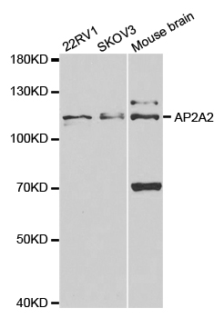 AP2A2 Antibody - Western blot analysis of extracts of various cell lines.