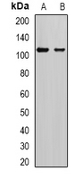 AP2A2 Antibody - Western blot analysis of AP2-alpha-2 expression in SKOV3 (A); mouse brain (B) whole cell lysates.