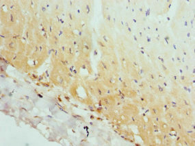 AP2A2 Antibody - Immunohistochemistry of paraffin-embedded human heart tissue at dilution 1:100