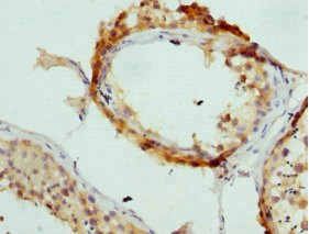 AP2A2 Antibody - Immunohistochemistry of paraffin-embedded human testis at dilution 1:100