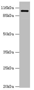 AP2A2 Antibody - Western blot All Lanes:AP2A2 antibody at 0.61ug/ml+mouse brain tissue Secondary Goat polyclonal to rabbit at 1/10000 dilution Predicted band size: 104,105,74 kDa Observed band size: 104 kDa