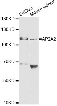 AP2A2 Antibody - Western blot analysis of extracts of various cell lines, using AP2A2 antibody at 1:1000 dilution. The secondary antibody used was an HRP Goat Anti-Rabbit IgG (H+L) at 1:10000 dilution. Lysates were loaded 25ug per lane and 3% nonfat dry milk in TBST was used for blocking.
