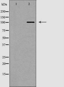 AP2A2 Antibody - Western blot analysis of mouse brain tissue lysate using AP2A2 antibody. The lane on the left is treated with the antigen-specific peptide.