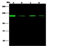 AP2A2 Antibody - Anti-AP2A2 rabbit polyclonal antibody at 1:500 dilution. Lane A: HepG2 Whole Cell Lysate. Lane B: HeLa Whole Cell Lysate. Lane C: Jurkat Whole Cell Lysate. Lane D: A431 Whole Cell Lysate. Lysates/proteins at 30 ug per lane. Secondary: Goat Anti-Rabbit IgG H&L (Dylight 800) at 1/10000 dilution. Developed using the Odyssey technique. Performed under reducing conditions. Predicted band size: 104 kDa. Observed band size: 120 kDa.