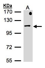 AP2B1 Antibody - Sample (30 ug of whole cell lysate). A: MOLT4. 7.5% SDS PAGE. AP2B1 antibody diluted at 1:500