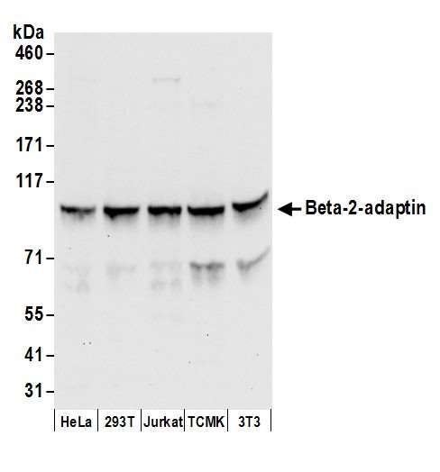 AP2B1 Antibody - Detection of human and mouse Beta-2-adaptin by western blot. Samples: Whole cell lysate (50 µg) from HeLa, HEK293T, Jurkat, mouse TCMK-1, and mouse NIH 3T3 cells prepared using NETN lysis buffer. Antibodies: Affinity purified rabbit anti-Beta-2-adaptin antibody used for WB at 0.1 µg/ml. Detection: Chemiluminescence with an exposure time of 10 seconds.