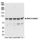 AP2B1 Antibody - Detection of human and mouse Beta-2-adaptin by western blot. Samples: Whole cell lysate (50 µg) from HeLa, HEK293T, Jurkat, mouse TCMK-1, and mouse NIH 3T3 cells prepared using NETN lysis buffer. Antibodies: Affinity purified rabbit anti-Beta-2-adaptin antibody used for WB at 0.1 µg/ml. Detection: Chemiluminescence with an exposure time of 10 seconds.