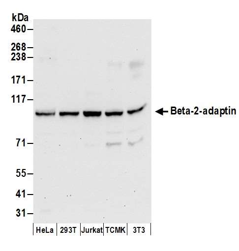 AP2B1 Antibody - Detection of human and mouse Beta-2-adaptin by western blot. Samples: Whole cell lysate (50 µg) from HeLa, HEK293T, Jurkat, mouse TCMK-1, and mouse NIH 3T3 cells prepared using NETN lysis buffer. Antibodies: Affinity purified rabbit anti-Beta-2-adaptin antibody used for WB at 0.1 µg/ml. Detection: Chemiluminescence with an exposure time of 30 seconds.