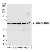 AP2B1 Antibody - Detection of human and mouse Beta-2-adaptin by western blot. Samples: Whole cell lysate (50 µg) from HeLa, HEK293T, Jurkat, mouse TCMK-1, and mouse NIH 3T3 cells prepared using NETN lysis buffer. Antibodies: Affinity purified rabbit anti-Beta-2-adaptin antibody used for WB at 0.1 µg/ml. Detection: Chemiluminescence with an exposure time of 30 seconds.
