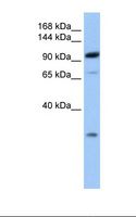 AP2B1 Antibody - Fetal brain lysate. Antibody concentration: 1.0 ug/ml. Gel concentration: 6-18%.  This image was taken for the unconjugated form of this product. Other forms have not been tested.