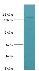 AP2B1 Antibody - Western blot. All lanes: AP-2 complex subunit beta antibody at 8 ug/ml+mouse brain tissue. Secondary antibody: Goat polyclonal to rabbit at 1:10000 dilution. Predicted band size: 105 kDa. Observed band size: 105 kDa.
