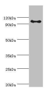 AP2B1 Antibody - Western blot All lanes: AP-2 complex subunit beta antibody at 8µg/ml + Mouse brain tissue Secondary Goat polyclonal to rabbit IgG at 1/10000 dilution Predicted band size: 105, 106, 99 kDa Observed band size: 105 kDa