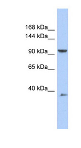 AP2B1 Antibody - AP2B1 antibody Western blot of OVCAR-3 cell lysate. This image was taken for the unconjugated form of this product. Other forms have not been tested.