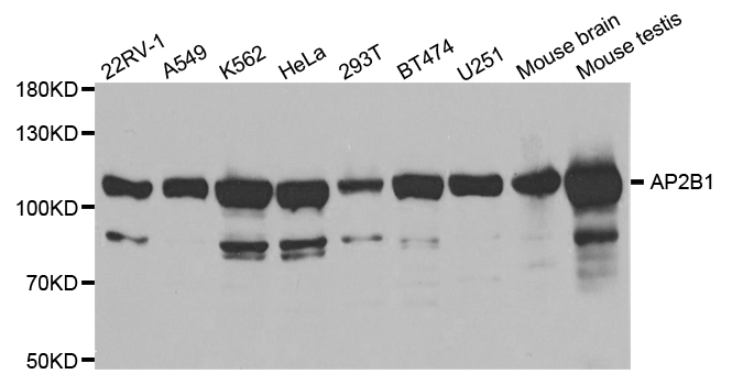 AP2B1 Antibody - Western blot analysis of extracts of various cell lines.
