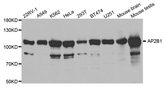 AP2B1 Antibody - Western blot analysis of extracts of various cell lines.