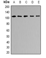 AP2B1 Antibody - Western blot analysis of AP2-beta-1 expression in A549 (A); K562 (B); HeLa (C); mouse brain (D); mouse testis (E) whole cell lysates.