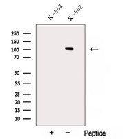 AP2B1 Antibody - Western blot analysis of extracts of K562 cells using AP2B1 antibody. The lane on the left was treated with blocking peptide.