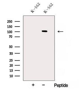 AP2B1 Antibody - Western blot analysis of extracts of K562 cells using AP2B1 antibody. The lane on the left was treated with blocking peptide.