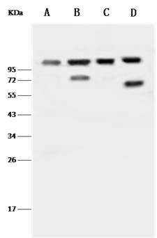 AP2B1 Antibody - Anti-AP2B1 rabbit polyclonal antibody at 1:500 dilution. Lane A: HeLa Whole Cell Lysate. Lane B: Jurkat Whole Cell Lysate. Lane C: K562 Whole Cell Lysate. Lane D: A431 Whole Cell Lysate. Lysates/proteins at 30 ug per lane. Secondary: Goat Anti-Rabbit IgG (H+L)/HRP at 1/10000 dilution. Developed using the ECL technique. Performed under reducing conditions. Predicted band size: 105 kDa. Observed band size: 105 kDa.