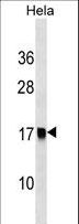 AP2S1 Antibody - AP2S1 Antibody western blot of HeLa cell line lysates (35 ug/lane). The AP2S1 antibody detected the AP2S1 protein (arrow).