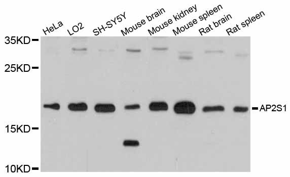 AP2S1 Antibody - Western blot analysis of extracts of various cell lines, using AP2S1 antibody at 1:3000 dilution. The secondary antibody used was an HRP Goat Anti-Rabbit IgG (H+L) at 1:10000 dilution. Lysates were loaded 25ug per lane and 3% nonfat dry milk in TBST was used for blocking. An ECL Kit was used for detection and the exposure time was 20s.