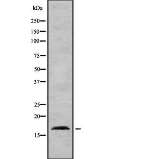 AP2S1 Antibody - Western blot analysis of AP2S1 using HepG2 whole lysates.