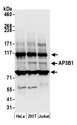 AP3B1 Antibody - Detection of human AP3B1 by western blot. Samples: Whole cell lysate (50 µg) from HeLa, HEK293T, and Jurkat cells prepared using NETN lysis buffer. Antibody: Affinity purified rabbit anti-AP3B1 antibody used for WB at 0.1 µg/ml. Detection: Chemiluminescence with an exposure time of 10 seconds.