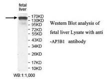AP3B1 Antibody - Western blot of AP3B1 antibody