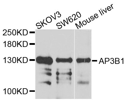 AP3B1 Antibody - Western blot analysis of extracts of various cells.