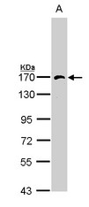 AP3B1 Antibody - Sample (30 ug of whole cell lysate). A: Hep G2. 7.5% SDS PAGE. AP3B1 antibody diluted at 1:1000. 
