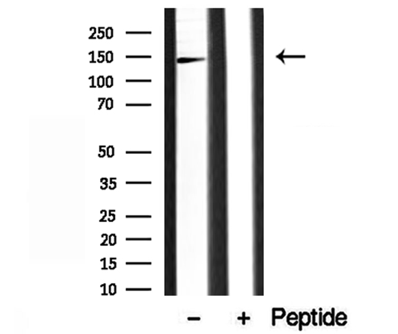 AP3B1 Antibody - Western blot analysis of extracts of COLO 320 cells using AP3B1 antibody.
