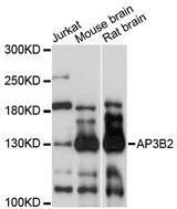 AP3B2 Antibody - Western blot analysis of extracts of various cell lines, using AP3B2 antibody at 1:3000 dilution. The secondary antibody used was an HRP Goat Anti-Rabbit IgG (H+L) at 1:10000 dilution. Lysates were loaded 25ug per lane and 3% nonfat dry milk in TBST was used for blocking. An ECL Kit was used for detection and the exposure time was 60s.