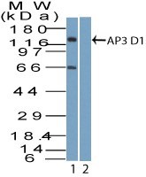AP3D1 / Adaptin Delta Antibody - Western Blot: AP3D1 Antibody - analysis using AP3 Delta antibody. HeLa lysate in the 1) absence and 2) presence of immunizing peptide, probed with AP3 Delta antibody at 2 ug/ml. goat anti-rabbit Ig HRP secondary antibody and PicoTect ECL substrate solution were used for this test.
