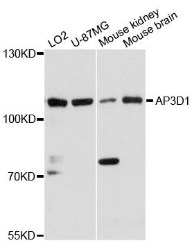 AP3D1 / Adaptin Delta Antibody - Western blot analysis of extracts of various cell lines, using AP3D1 antibody at 1:3000 dilution. The secondary antibody used was an HRP Goat Anti-Rabbit IgG (H+L) at 1:10000 dilution. Lysates were loaded 25ug per lane and 3% nonfat dry milk in TBST was used for blocking. An ECL Kit was used for detection and the exposure time was 90s.