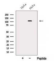 AP3D1 / Adaptin Delta Antibody - Western blot analysis of extracts of HeLa cells using AP3D1 antibody. The lane on the left was treated with blocking peptide.