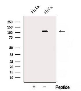 AP3D1 / Adaptin Delta Antibody - Western blot analysis of extracts of HeLa cells using AP3D1 antibody. The lane on the left was treated with blocking peptide.