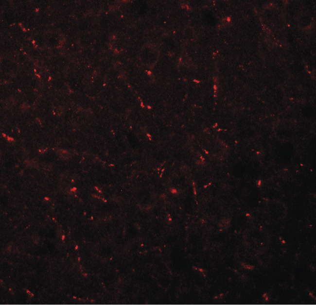 AP3M1 Antibody - Immunofluorescence of AP3M1 in mouse brain tissue with AP3M1 antibody at 20 ug/ml.