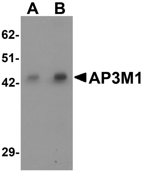 AP3M1 Antibody - Western blot analysis of AP3M1 in human brain tissue lysate with AP3M1 antibody at (A) 1 and (B) 2 ug/ml .