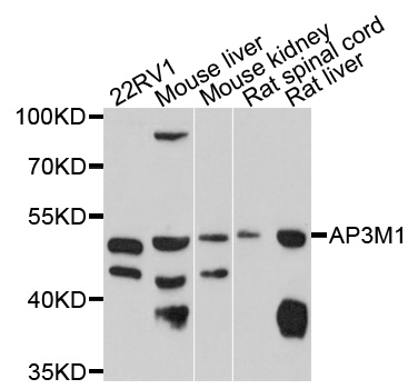 AP3M1 Antibody - Western blot analysis of extracts of various cell lines, using AP3M1 antibody at 1:1000 dilution. The secondary antibody used was an HRP Goat Anti-Rabbit IgG (H+L) at 1:10000 dilution. Lysates were loaded 25ug per lane and 3% nonfat dry milk in TBST was used for blocking. An ECL Kit was used for detection and the exposure time was 90s.