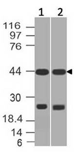 AP3M1 Antibody - Fig-1: Western blot analysis of AP3M1. Anti-AP3M1 antibody was used at 1 µg/ml on (1) PC3 and (2) A375 lysates.