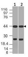 AP3M1 Antibody - Fig-1: Western blot analysis of AP3M1. Anti-AP3M1 antibody was used at 1 µg/ml on (1) PC3 and (2) A375 lysates.