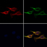 AP3M1 Antibody - Staining HeLa cells by IF/ICC. The samples were fixed with PFA and permeabilized in 0.1% Triton X-100, then blocked in 10% serum for 45 min at 25°C. Samples were then incubated with primary Ab(1:200) and mouse anti-beta tubulin Ab(1:200) for 1 hour at 37°C. An AlexaFluor594 conjugated goat anti-rabbit IgG(H+L) Ab(1:200 Red) and an AlexaFluor488 conjugated goat anti-mouse IgG(H+L) Ab(1:600 Green) were used as the secondary antibod