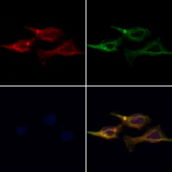 AP3M1 Antibody - Staining HeLa cells by IF/ICC. The samples were fixed with PFA and permeabilized in 0.1% Triton X-100, then blocked in 10% serum for 45 min at 25°C. Samples were then incubated with primary Ab(1:200) and mouse anti-beta tubulin Ab(1:200) for 1 hour at 37°C. An AlexaFluor594 conjugated goat anti-rabbit IgG(H+L) Ab(1:200 Red) and an AlexaFluor488 conjugated goat anti-mouse IgG(H+L) Ab(1:600 Green) were used as the secondary antibod
