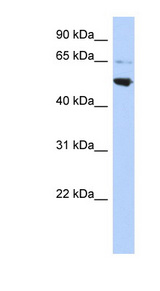 AP3M2 Antibody - AP3M2 antibody Western blot of HepG2 cell lysate. This image was taken for the unconjugated form of this product. Other forms have not been tested.