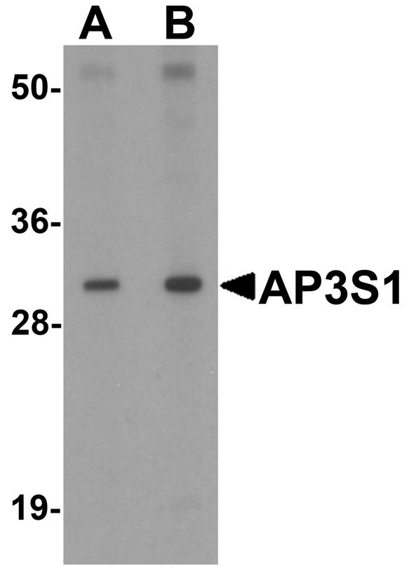 AP3S1 Antibody - Western blot analysis of AP3S1 in mouse kidney tissue lysate with AP3S1 antibody at (A) 1 and (B) 2 ug/ml .