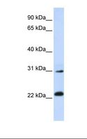 AP3S1 Antibody - Jurkat cell lysate. Antibody concentration: 1.0 ug/ml. Gel concentration: 12%.  This image was taken for the unconjugated form of this product. Other forms have not been tested.