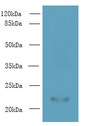 AP3S2 Antibody - Western blot. All lanes: AP3S2 antibody at 6 ug/ml+ A549 whole cell lysate Goat polyclonal to rabbit at 1:10000 dilution. Predicted band size: 22 kDa. Observed band size: 22 kDa.