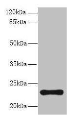 AP3S2 Antibody - Western blot All lanes: AP3S2 antibody at 6µg/ml + A549 whole cell lysate Secondary Goat polyclonal to rabbit IgG at 1/10000 dilution Predicted band size: 23, 44 kDa Observed band size: 23 kDa