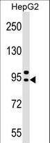 AP4B1 Antibody - AP4B1 Antibody western blot of HepG2 cell line lysates (35 ug/lane). The AP4B1 antibody detected the AP4B1 protein (arrow).